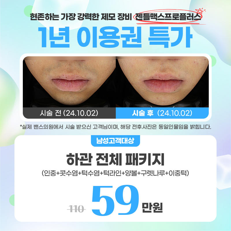 밴스의원 남성 하관 전체 패키지 이벤트 안내